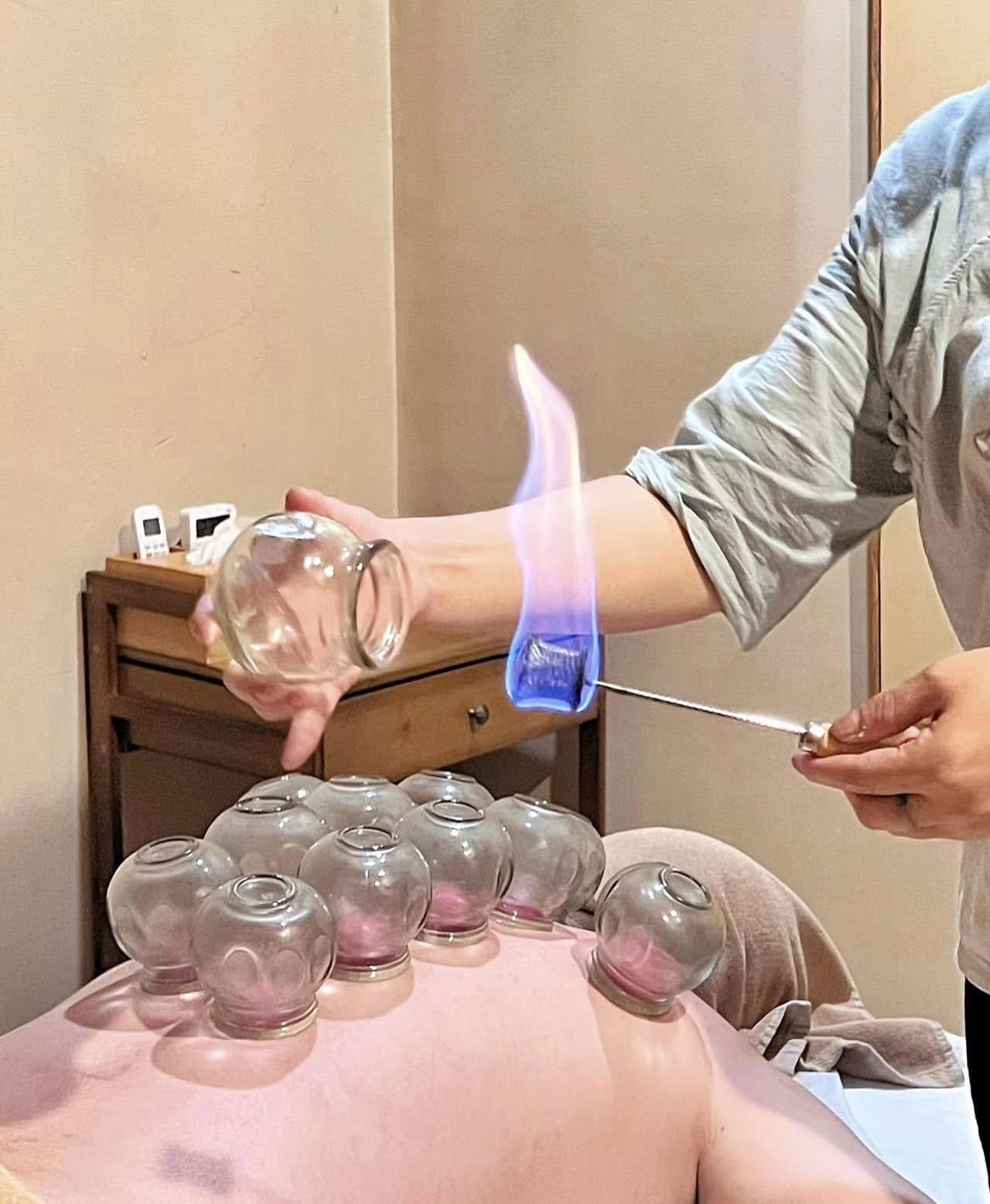 Cupping therapy treatment